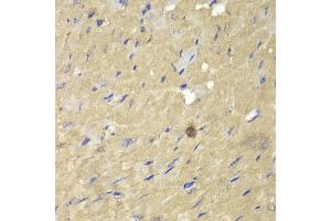 Immunohistochemistry (IHC) image for anti-Aflatoxin Beta1 Aldehyde Reductase (AKR7A2) (AA 100-359) antibody (ABIN3021782) (AKR7A2 Antikörper  (AA 100-359))