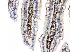 IHC analysis of PKC alpha using anti-PKC alpha antibody (ABIN3043549). (PKC alpha Antikörper  (AA 153-342))