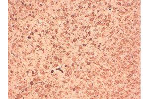 Immunohistochemistry (IHC) image for anti-Potassium Voltage-Gated Channel, Shab-Related Subfamily, Member 1 (KCNB1) (C-Term) antibody (ABIN6658058)