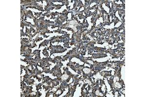 IHC analysis of GLB1/Beta-galactosidase using anti-GLB1/Beta-galactosidase antibody (ABIN7601806). (GLB1 Antikörper  (AA 46-655))