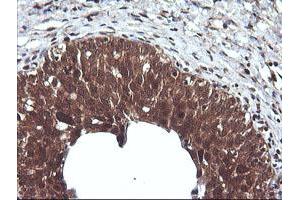 Image no. 6 for anti-Cancer/testis Antigen 1B (CTAG1B) antibody (ABIN1499895) (CTAG1B Antikörper)