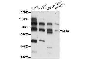 Western blot analysis of extracts of various cell lines, using MNS1 antibody (ABIN6293805) at 1:3000 dilution. (MNS1 Antikörper)
