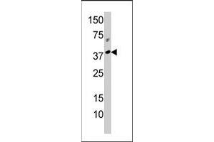 Western blot analysis of RCL1 polyclonal antibody  in A-375 cell line lysate (35 ug/lane). (RCL1 Antikörper  (N-Term))