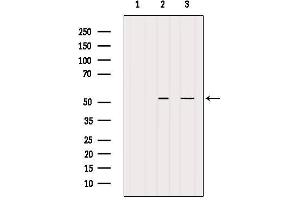 Western blot analysis of extracts from various samples, using BAGE5 Antibody.