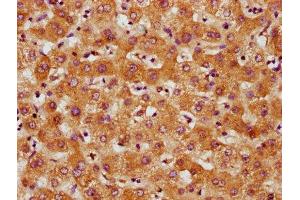 IHC image of ABIN7148683 diluted at 1:500 and staining in paraffin-embedded human liver tissue performed on a Leica BondTM system. (CRTC3 Antikörper  (AA 373-480))