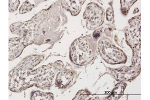 Immunoperoxidase of purified MaxPab antibody to ZNF584 on formalin-fixed paraffin-embedded human placenta. (ZNF584 Antikörper  (AA 1-421))