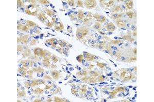 Immunohistochemistry of paraffin-embedded Human stomach using SPATA4 Polyclonal Antibody at dilution of 1:100 (40x lens). (SPATA4 Antikörper)