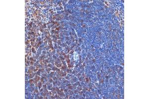 Immunohistochemistry of paraffin-embedded mouse spleen using PI3 Kinase p110 delta Rabbit mAb (ABIN7269326) at dilution of 1:100 (40x lens). (PIK3CD Antikörper)