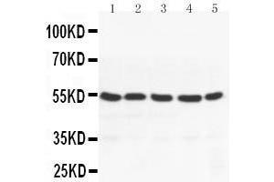 Anti-PPAR gamma antibody, Western blotting Lane 1: MM453 Cell Lysate Lane 2: MM231 Cell Lysate Lane 3: HELA Cell Lysate Lane 4: JURKAT Cell Lysate Lane 5:  Cell Lysate (PPARG Antikörper  (N-Term))