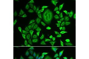 Immunofluorescence analysis of MCF-7 cells using RBP3 Polyclonal Antibody (RBP3 Antikörper)