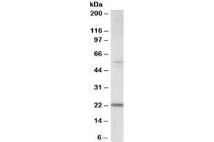 Western blot testing of human kidney lysate with MAD4 antibody at 0. (MXD4 Antikörper)