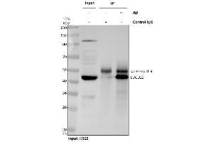 anti-Succinate-CoA Ligase, GDP-Forming, beta Subunit (SUCLG2) (AA 42-424) antibody