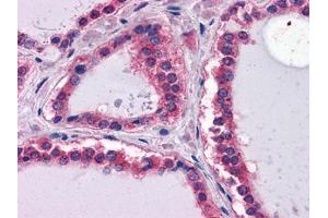 Immunohistochemical analysis of paraffin-embedded human Thyroid tissues using LAMB1 mouse mAb (Laminin beta 1 Antikörper  (AA 31-270))