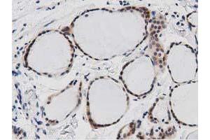 Immunohistochemical staining of paraffin-embedded Human Kidney tissue using anti-DNAJA2 mouse monoclonal antibody. (DNAJA2 Antikörper)