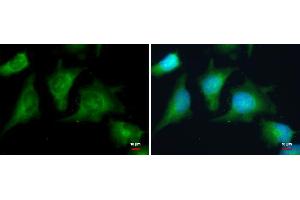 ICC/IF Image PRKAR2A antibody detects PRKAR2A protein at cytoplasm by immunofluorescent analysis. (PRKAR2A Antikörper  (Center))