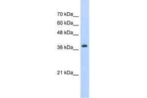 Western Blotting (WB) image for anti-Chromobox Homolog 6 (CBX6) antibody (ABIN2461847) (CBX6 Antikörper)