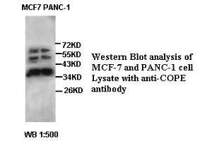 Image no. 2 for anti-Coatomer Protein Complex, Subunit epsilon (COPE) antibody (ABIN791222) (COPE Antikörper)