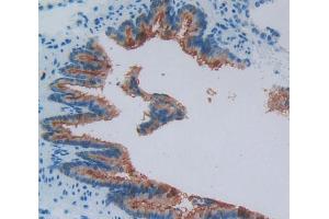 Used in DAB staining on fromalin fixed paraffin- embedded bronchus tissue (VPREB1 Antikörper  (AA 43-128))