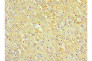 Immunohistochemistry of paraffin-embedded human liver tissue using ABIN7142463 at dilution of 1:100 (ABAT Antikörper  (AA 29-300))