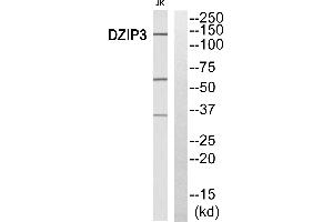 Immunohistochemistry analysis of paraffin-embedded human breast carcinoma tissue, using DZIP3 antibody.