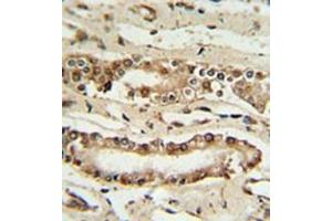 Immunohistochemistry analysis in formalin fixed and paraffin embedded lung tissue reacted with FOXP1 Antibody (C-term) followed by peroxidase conjugation of the secondary antibody and DAB staining. (FOXP1 Antikörper  (C-Term))