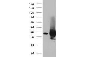 Western Blotting (WB) image for anti-Pyrroline-5-Carboxylate Reductase Family, Member 2 (PYCR2) antibody (ABIN1499982) (PYCR2 Antikörper)