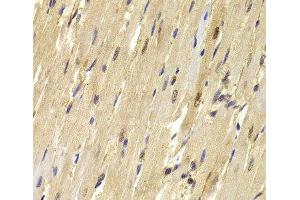 Immunohistochemistry of paraffin-embedded Mouse heart using TOPBP1 Polyclonal Antibody at dilution of 1:100 (40x lens).