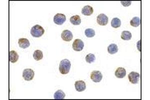 AP20058PU-N CD107b/LAMP2 antibody staining of HepG2 cells by Immunocytochemistry at 10 μg/ml. (LAMP2 Antikörper  (C-Term))