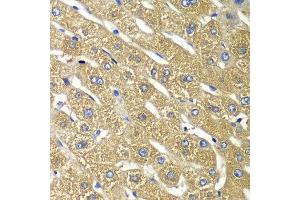 Immunohistochemistry of paraffin-embedded human liver injury using TMED10 antibody at dilution of 1:100 (x40 lens). (TMED10 Antikörper)