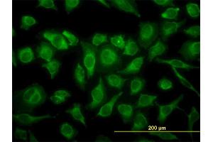 Immunofluorescence of monoclonal antibody to MAPK12 on HeLa cell. (MAPK12 Antikörper  (AA 251-367))