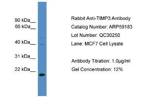 WB Suggested Anti-TIMP3  Antibody Titration: 0. (TIMP3 Antikörper  (N-Term))