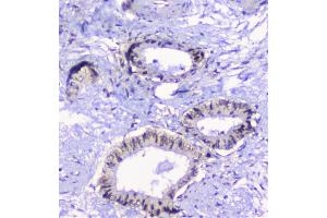 IHC analysis of CFP using anti-CFP antibody (ABIN6719298). (CFP Antikörper)
