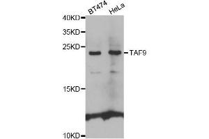 Western blot analysis of extracts of various cell lines, using TAF9 antibody. (TAF9 Antikörper  (AA 1-172))