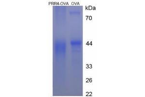 Image no. 2 for Proline Rich 4 (Lacrimal) (PRR4) (AA 17-30) peptide (Ovalbumin) (ABIN5666360) (Proline Rich 4 (Lacrimal) (PRR4) (AA 17-30) peptide (Ovalbumin))