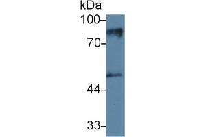 Detection of PKCe in Mouse Cerebrum lysate using Monoclonal Antibody to Protein Kinase C Epsilon (PKCe) (PKC epsilon Antikörper  (AA 403-672))