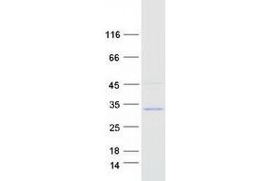 Western Blotting (WB) image for Dual Specificity Phosphatase 19 (DUSP19) (Transcript Variant 1) protein (Myc-DYKDDDDK Tag) (ABIN2719832)