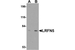 Western Blotting (WB) image for anti-Leucine Rich Repeat and Fibronectin Type III Domain Containing 5 (LRFN5) (C-Term) antibody (ABIN1030492) (LRFN5 Antikörper  (C-Term))