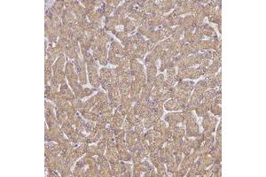 Immunohistochemical staining of human liver with UTP23 polyclonal antibody  shows moderate cytoplasmic positivity in hepatocytes at 1:50-1:200 dilution.
