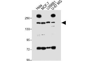 All lanes : Anti-UTY_HUN at 1:1000 dilution Lane 1: Hela whole cell lysate Lane 2: MCF-7 whole cell lysate Lane 3: U266B1 whole cell lysate Lane 4: U-87 MG whole cell lysate Lysates/proteins at 20 μg per lane. (UTY Antikörper  (C-Term))