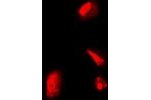 Immunofluorescent analysis of RPS5 staining in Hela cells. (RPS5 Antikörper)