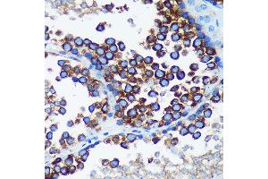 Immunohistochemistry of paraffin-embedded Mouse testis using R Rabbit pAb (ABIN7269785) at dilution of 1:100 (40x lens). (RABGAP1 Antikörper  (AA 830-1069))