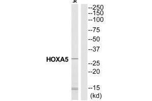 Western blot analysis of extracts from Jurkat cells, using HXA5 antibody. (HOXA5 Antikörper  (N-Term))