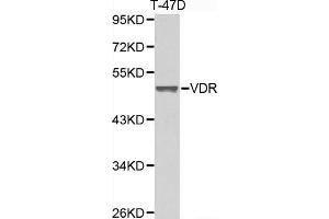 Western blot analysis of extracts of T-47D cell lines, using VDR antibody. (Vitamin D Receptor Antikörper  (AA 1-300))