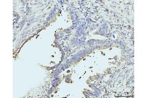 IHC analysis of RPL23 using anti-RPL23 antibody (ABIN7599808). (RPL23 Antikörper  (AA 12-136))