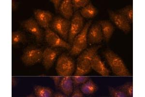 Immunofluorescence analysis of HeLa cells using B3GNT4 Polyclonal Antibody at dilution of 1:100. (B3GNT4 Antikörper)