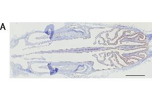 Immunohistochemistry analysis of the expression of the mu and alpha class GSTs. (GSTM1 Antikörper  (AA 1-218))