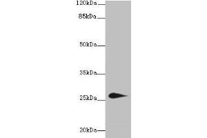 Western blot All lanes: TMEM174 antibody at 0. (TMEM174 Antikörper  (AA 94-243))