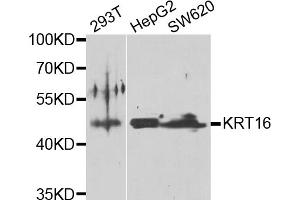 Western blot analysis of extracts of various cell lines, using KRT16 antibody (ABIN5975146) at 1/1000 dilution. (KRT16 Antikörper)