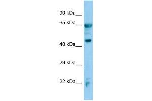 Host:  Rabbit  Target Name:  Adh7  Sample Type:  Mouse Lung lysates  Antibody Dilution:  1. (ADH7 Antikörper  (C-Term))