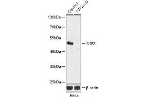 Western blot analysis of extracts from normal (control) and TDP2 knockout (KO) HeLa cells using TDP2 Polyclonal Antibody at dilution of 1:3000. (TDP2 Antikörper)